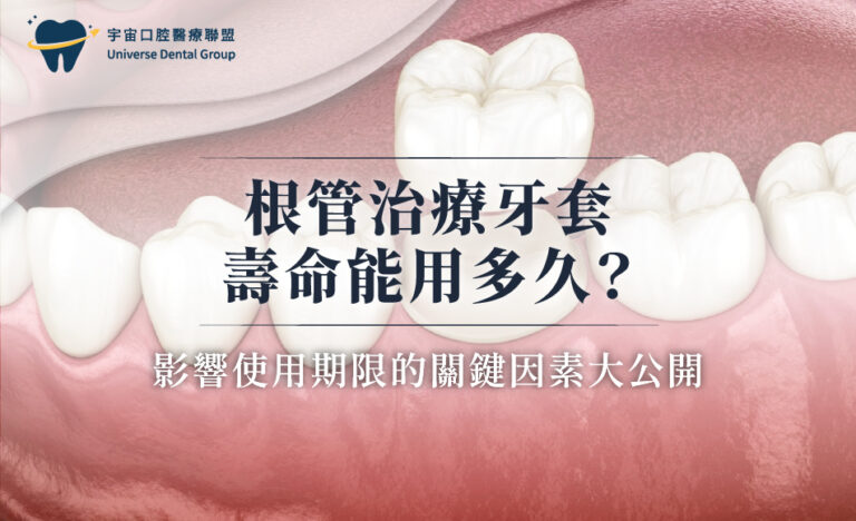 根管治療牙套壽命能用多久？影響使用期限的關鍵因素大公開
