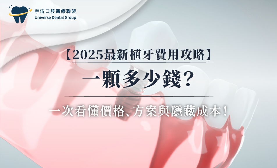 【2025最新植牙費用攻略】一顆多少錢？一次看懂價格、方案與隱藏成本！